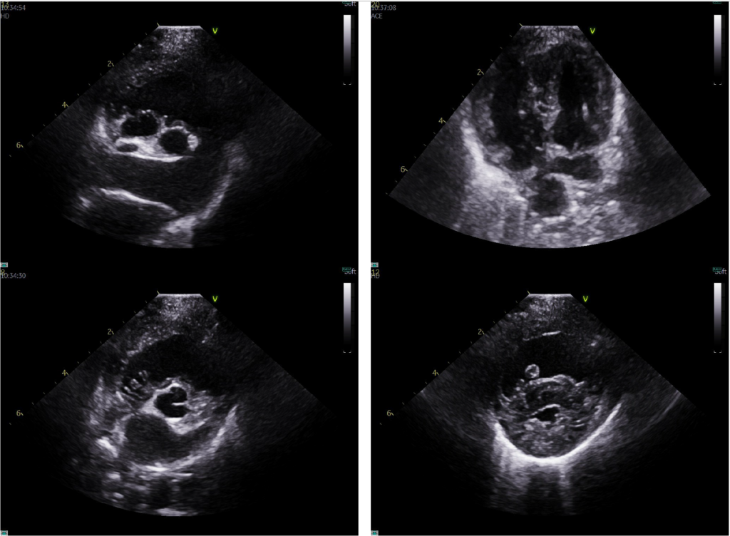 Echocardiography