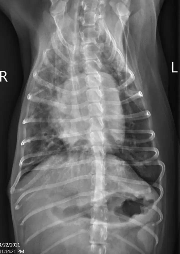 VD thoracic radiograph