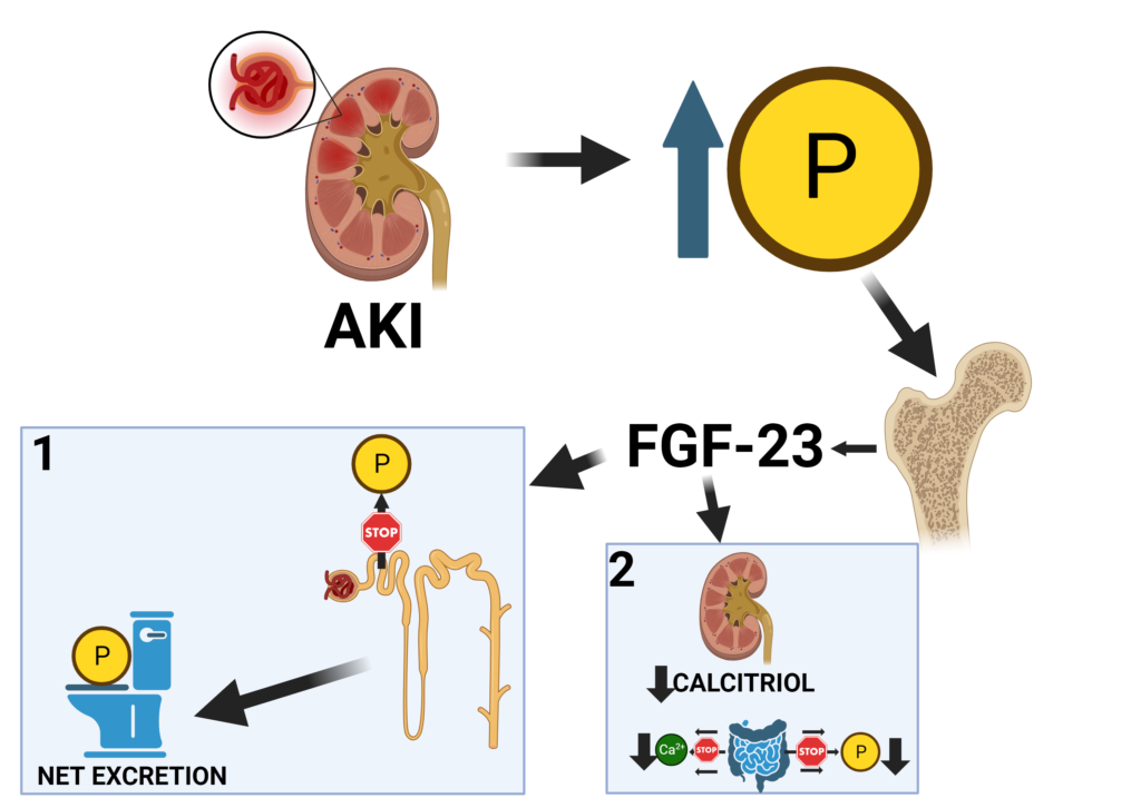 AKI-induced hypocalcemia