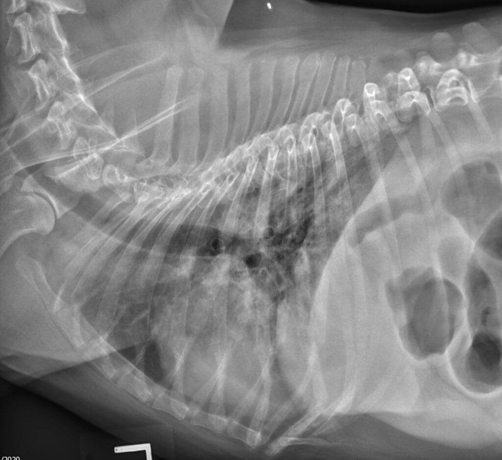 Acute respiratory distress
