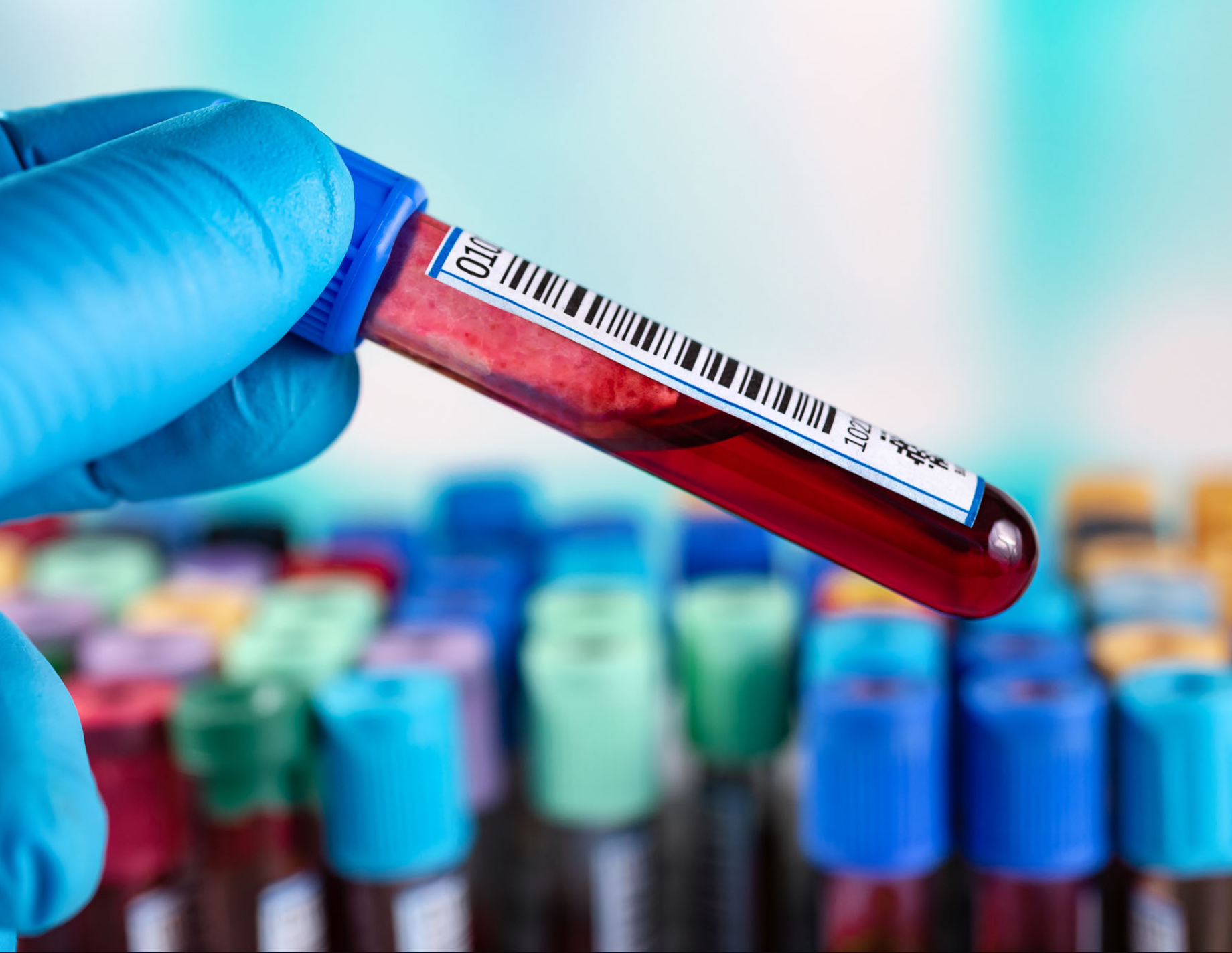 Can both prolonged PT/PTT and shortened PT/PTT be indicative of a ...